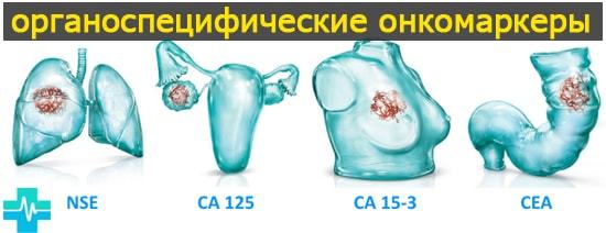 Онкомаркеры – расшифровка, таблица нормы