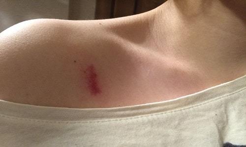 Вольтарен - 35 отзывов, инструкция по применению