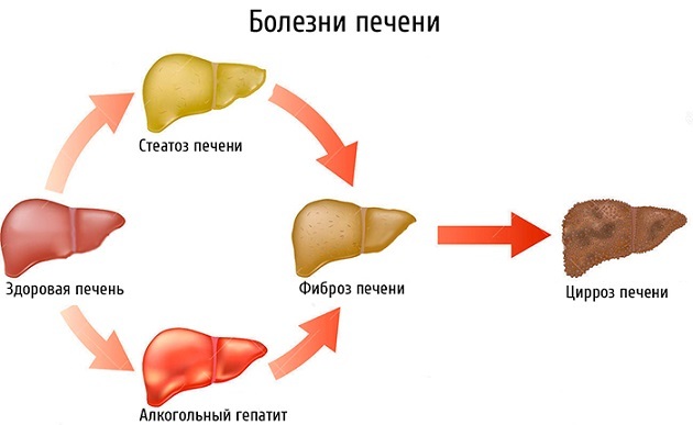 Показатели RDW в анализе крови иследование расшифровка диагноз