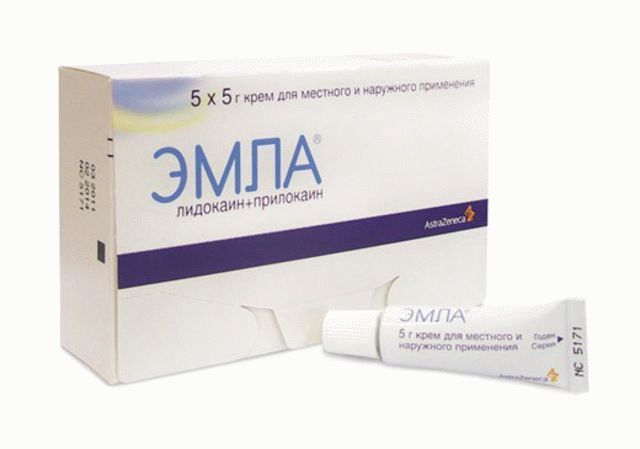 Узлы в прямой кишке - Геморроидальные узлы
