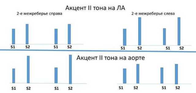 Методика аускультации сердца.