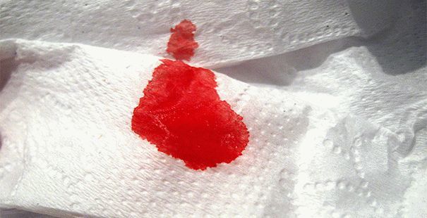 Может ли геморрой пройти сам, можно ли вылечить свечами полностью