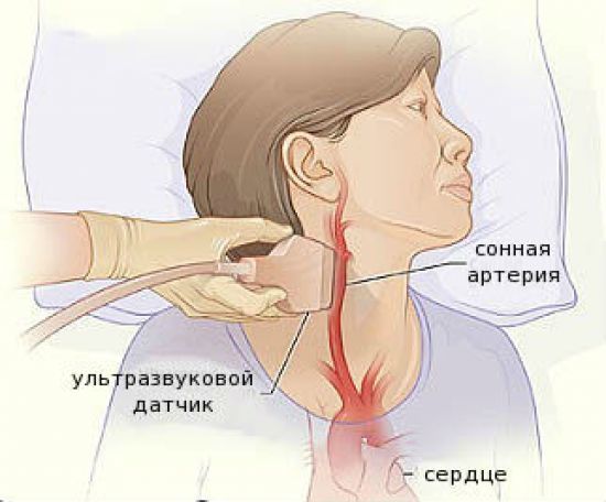 Что такое УЗДГ сосудов шеи и головы: как делают и что показывает УЗИ головного мозга, цена и расшифровка