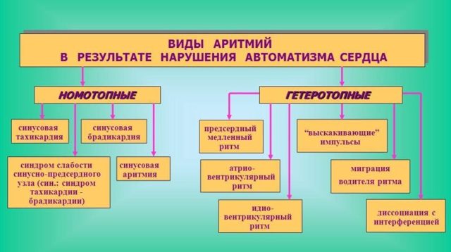 Аритмия какая бывает