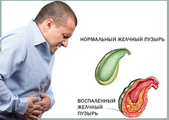 Как понизить или уменьшить лейкоциты в крови быстро