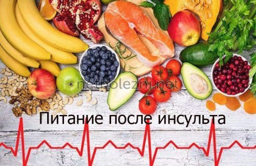 Предпосылки инсульта головного мозга у женщин - как избежать инсульта у женщин