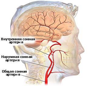 Бифуркация - это раздвоение трахеи, аорты или сонной артерии