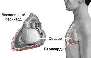 Давит в грудной клетке посередине: причины и лечение