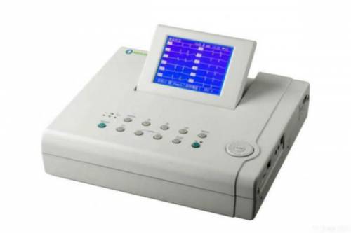 Стандартные отведения от конечностей - 1,2,3