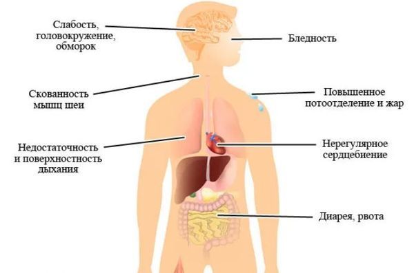 Код мкб гипотония неуточненная -