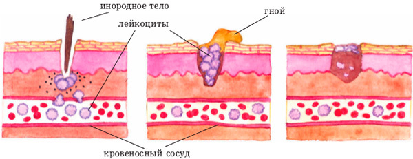 Функции лейкоцитов – за что отвечают? - Диагностика