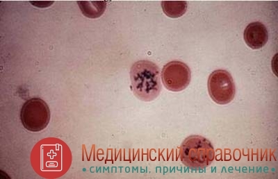 Ретикулоциты - норма у детей и взрослых, повышены и понижены в мазке крови