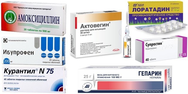 Флебит - что это такое, причины, симптомы, лечение
