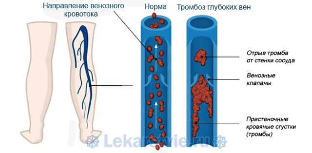 Кардиомагнил - официальная инструкция по применению, аналоги