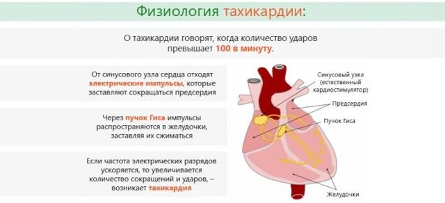 Синусовая тахикардия - что это такое. Синусовая тахикардия у взрослых и детей, нормы сердцебиения на ЭКГ.
