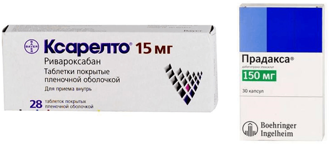 Мерцательная аритмия сердца - причины и симптомы, лечение консервативное и оперативное