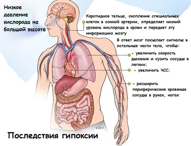 Гипоксия - что это такое, причины острой и хронической, методы лечения, осложнения и профилактика