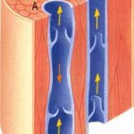 Варикоз, варикозное расширение вен ног: лечение, симптомы