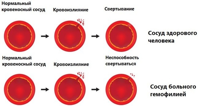 Аскофен — инструкция, действие, применение
