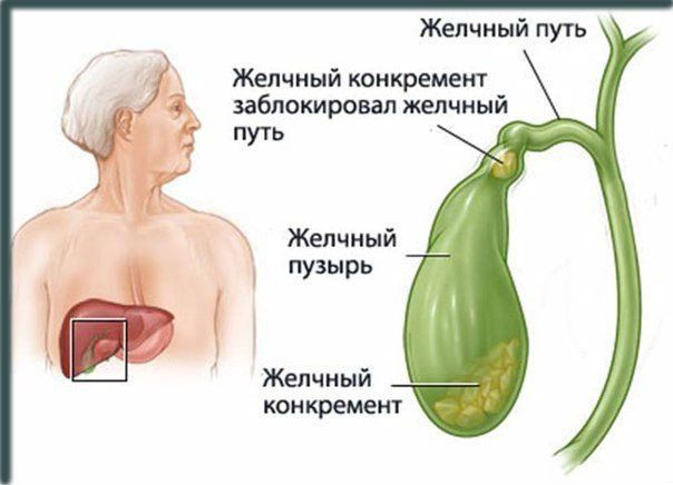Что это значит - у взрослого повышен общий билирубин