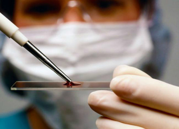 Первая отрицательная группа крови у мужчин и женщин