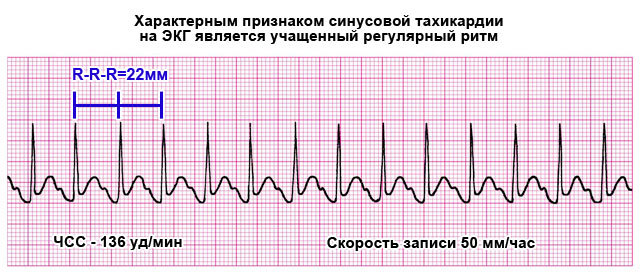 Корвалол - применение, инструкция, показания