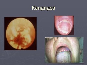 Неовир - официальная инструкция по применению, аналоги