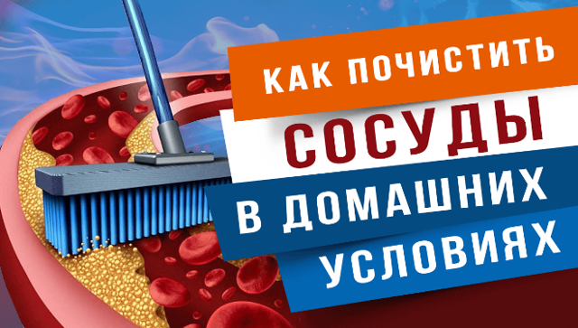 Очищение сосудов. Как очищать сосуды разумно, безопасно, в домашних условиях?