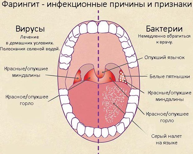 Люголь спрей: инструкция по применению и состав