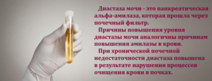 Норма диастазы в моче у взрослых и детей: при панкреатите, анализ, расшифровка результатов