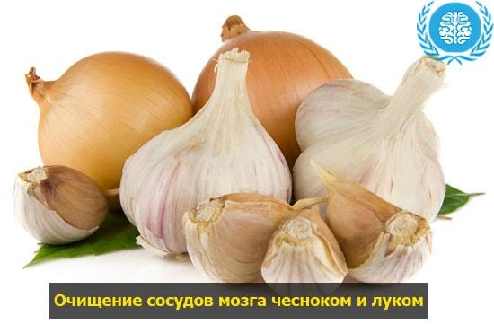 Чистка сосудов головного мозга — ТОП 5 эффективных методов для очищение и укрепление сосудов мозга