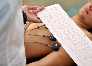 Синусовый ритм: что это в заключении ЭКГ, расшифровка и норма