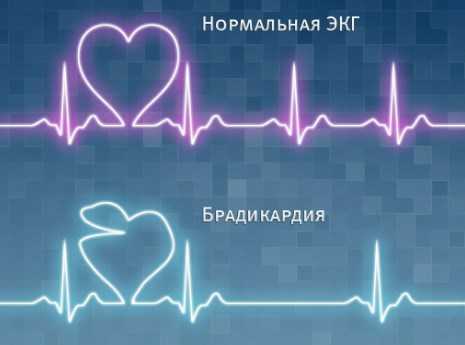 Как повысить пульс в домашних условиях