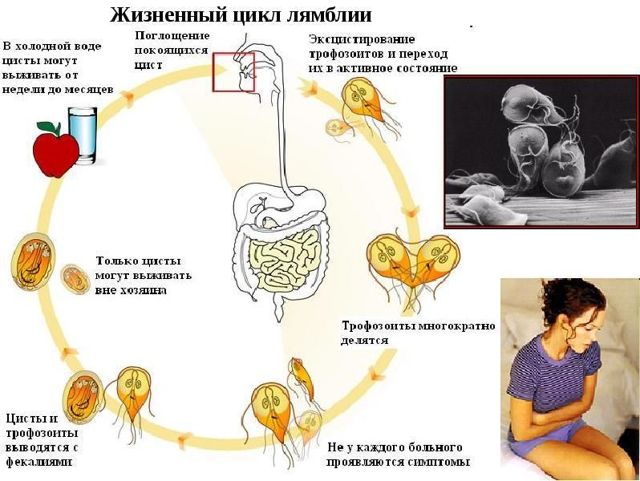 Лечение лямблиоза у взрослых медикаментозными средствами. Детальные схемы лечения и дозировка препаратов. Лямблии у взрослых: симптомы и лечение 18964 0