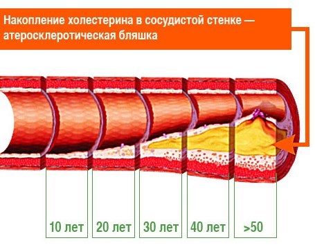 Норма артериального давления (АД) у взрослых по возрастам – таблица