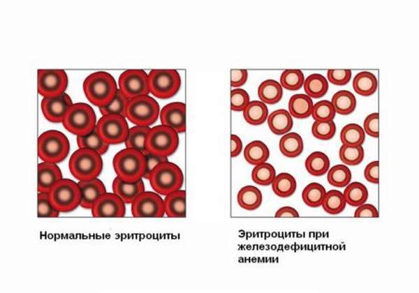Эритроциты в крови как снизить
