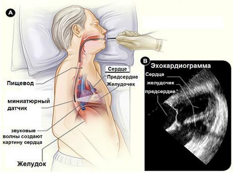 Нарушение ритма сердца — Причины и основные признаки сердечного ритма, методы лечения, советы врачей