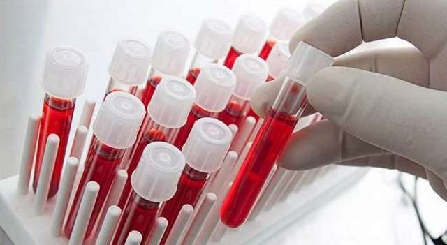 Заболевания по группе крови (болезни, влияющие на здоровье)