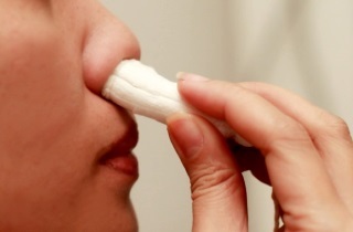 Первая помощь при кровотечении из носа: как правильно оказать медицинскую помощь (алгоритм) при сильном кровотечении, что нужно делать чтобы из носа пошла кровь без боли