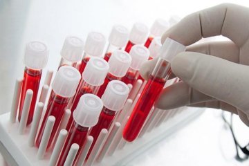 Биохимический анализ крови: расшифровка у взрослых