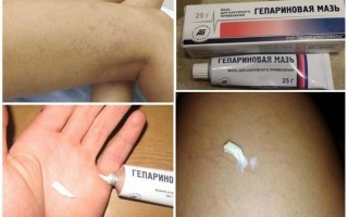 Гепариновая мазь при варикозе ног на сайте варикоз