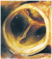 Сердце человека: анатомическое строение, функции, принцип работы