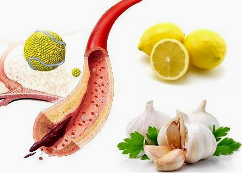 Как очистить сосуды от холестерина и вредных скоплений взрослым