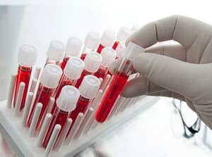 Что делать, если у ребенка повышенные базофилы