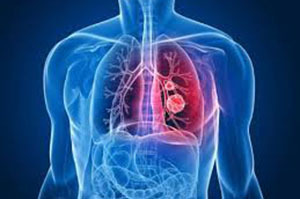 Боль в сердце при кашле - Всё о сердце