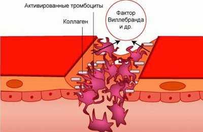 Агрегация тромбоцитов с АДФ, адреналином, ристомицином, коллагеном – норма. Что такое агрегация, гиперагрегация, гипоагрегация тромбоцитов?