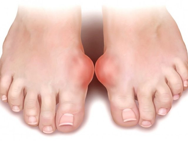 Ортофен мазь: инструкция по применению, состав, цена