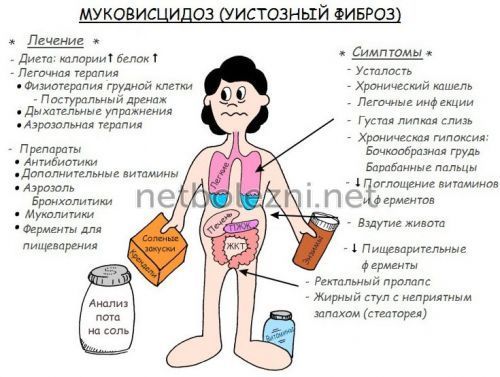 Густая, вязкая и тягучая слюна во рту: причины густой слюны, лечение