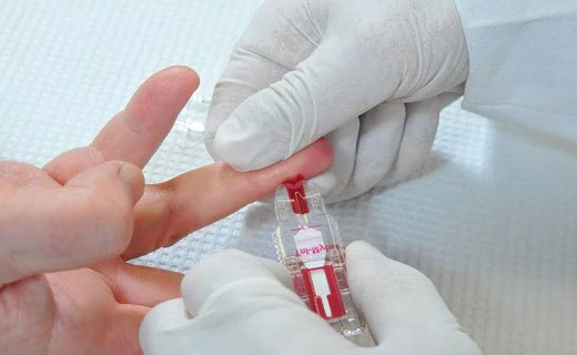 Гемоглобин А1С норма (таблица). Гемоглобин А1С повышен или понижен - что это значит