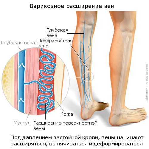 Анавенол - инструкция по применению, отзывы